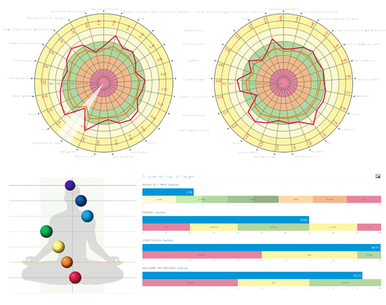 Instruments de mesures pro pour diagnostique électromagnétique - Arkanova